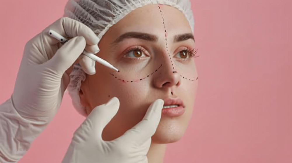 Нитевая блефаропластика век - 3